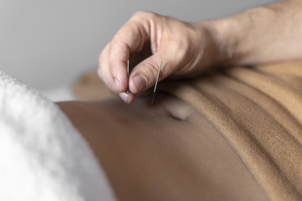 Acupuncture and Colitis: Can It Help?