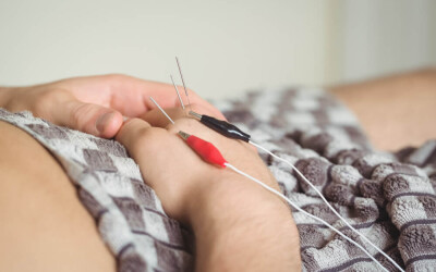 Electro-Acupuncture for Mental Health: Relieving Anxiety and Depression with E-Stim