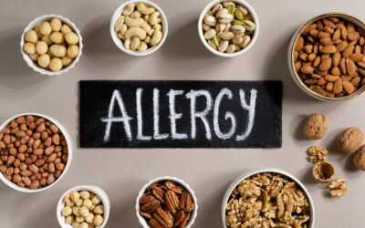 Functional Medicine’s Approach to Food Allergies and Intolerances