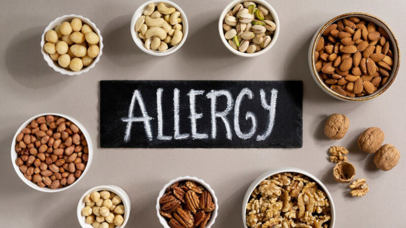 functional medicines approach to food allergies and intolerances